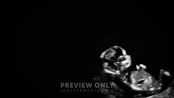 Perfectly_Imperfect_16x9-TITLE-3#preset=tg_title3.jpg