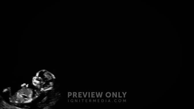 Perfectly_Imperfect_16x9-CONTENT-3#preset=tg_alt3.jpg